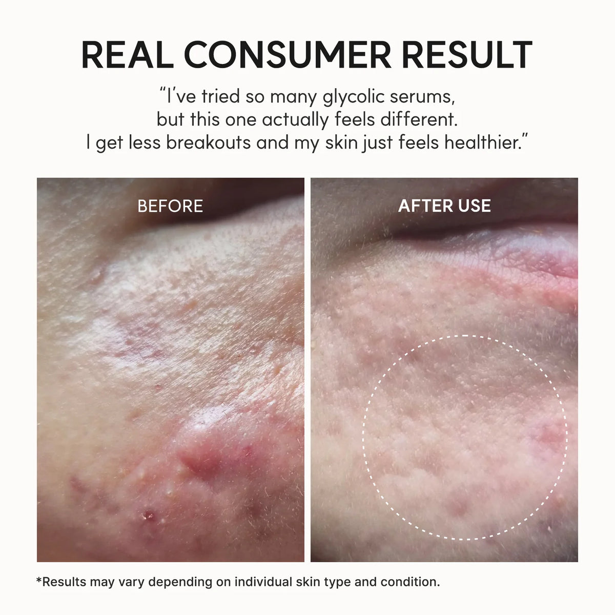 SkinPearl™ Glass Skin Overnight Treatment
