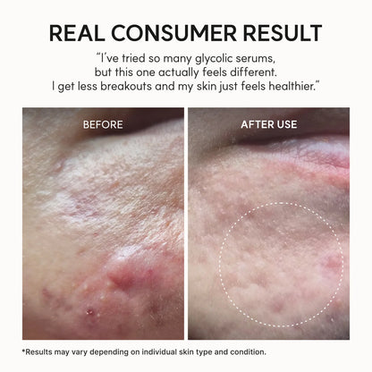 SkinPearl™ Glass Skin Overnight Treatment