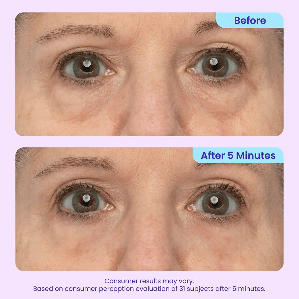 SkinPearl™  Instant Lift Eye Gel