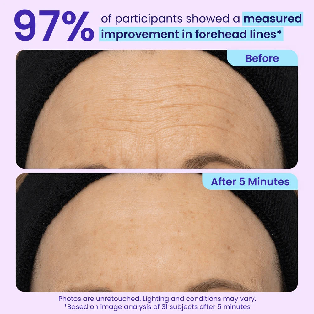 SkinPearl™  Instant Lift Eye Gel