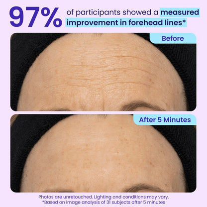 SkinPearl™  Instant Lift Eye Gel