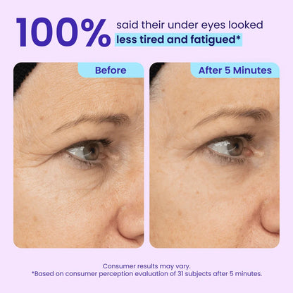 SkinPearl™  Instant Lift Eye Gel