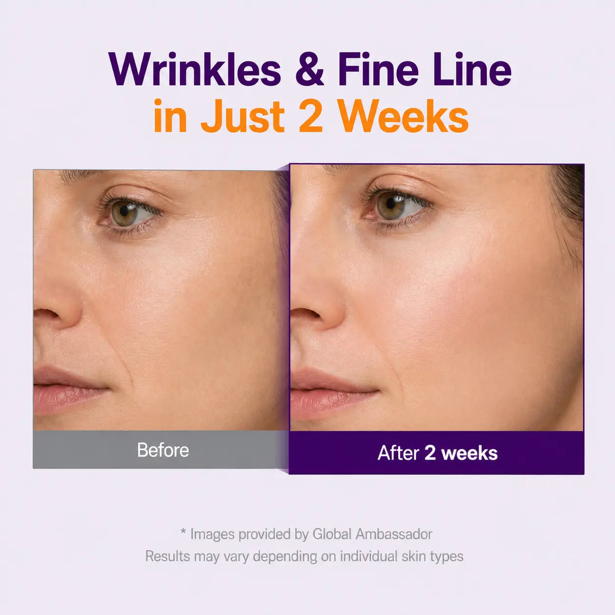 SkinPearl™ Age Reverse Elixir Serum