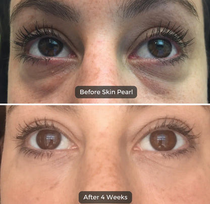 SkinPearl™ Freeze-Dried Collagen Eye Masks